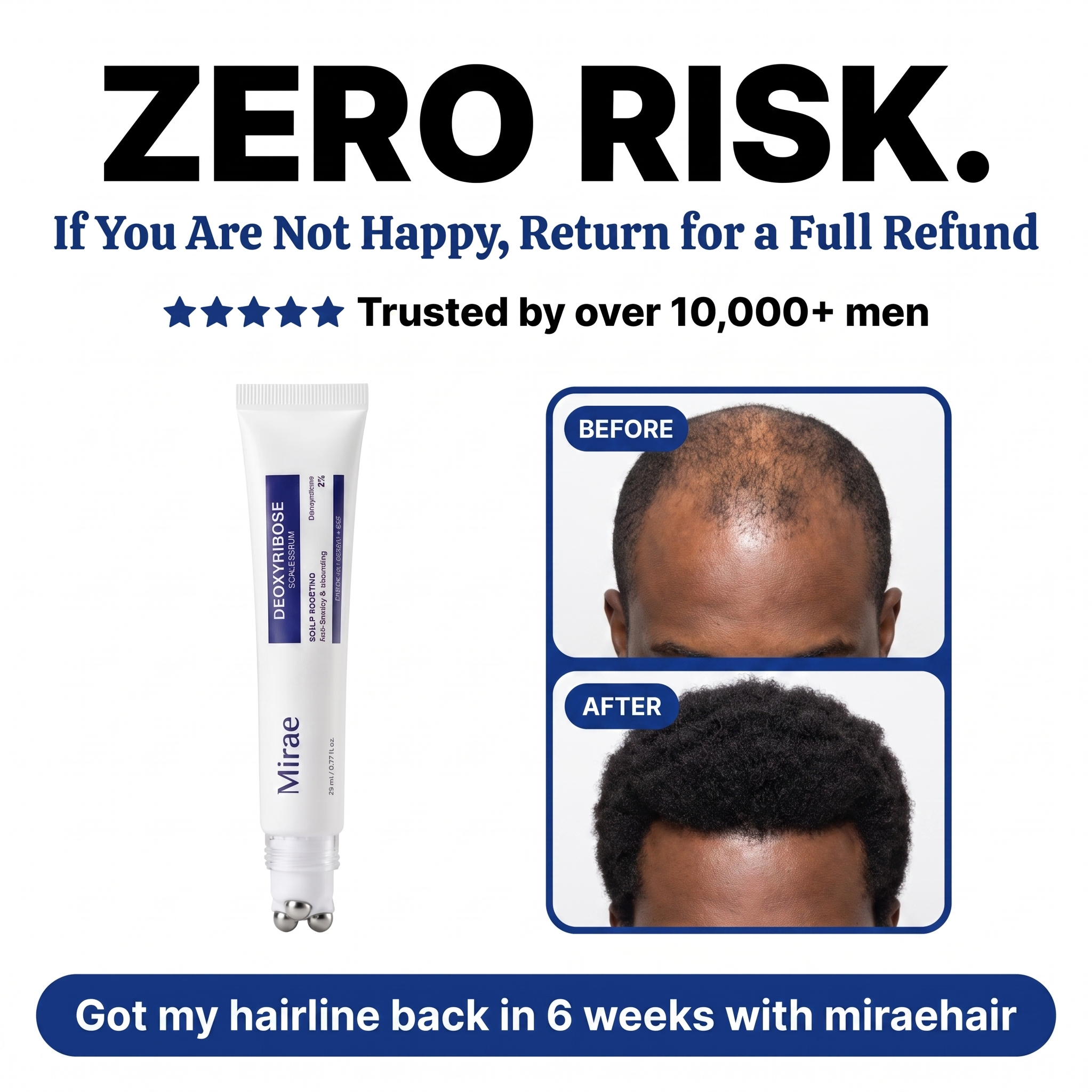 Deoxyribose Scalp Serum