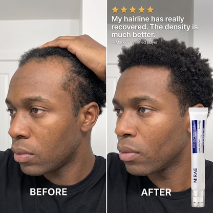 Deoxyribose Scalp Serum