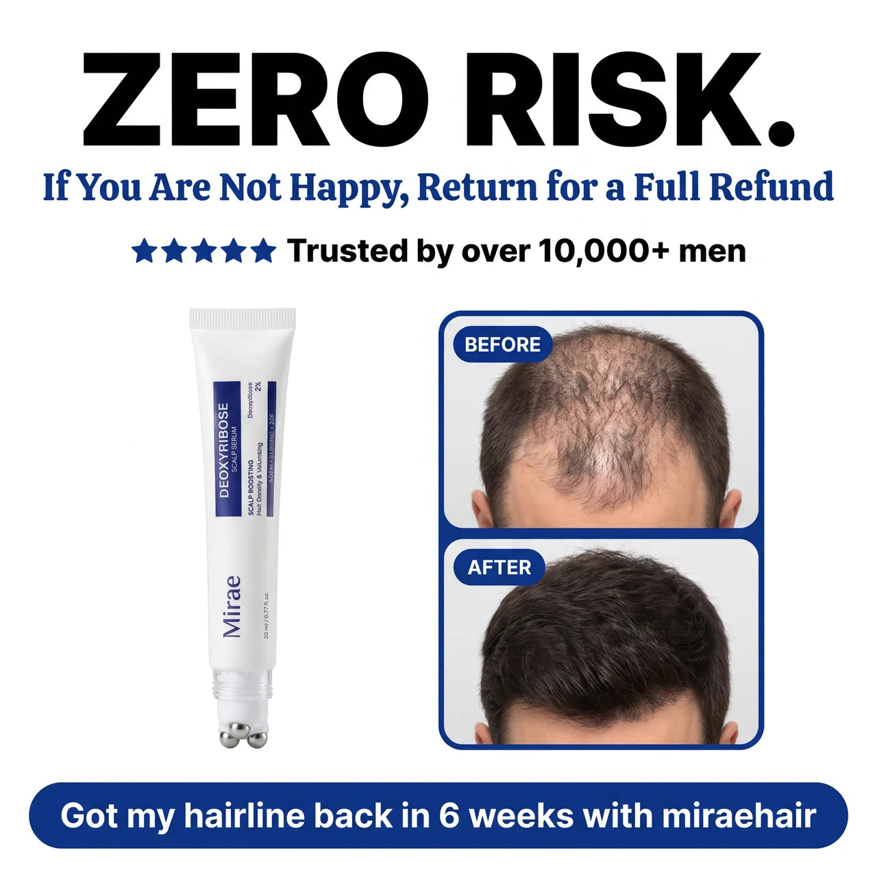 Deoxyribose Scalp Serum