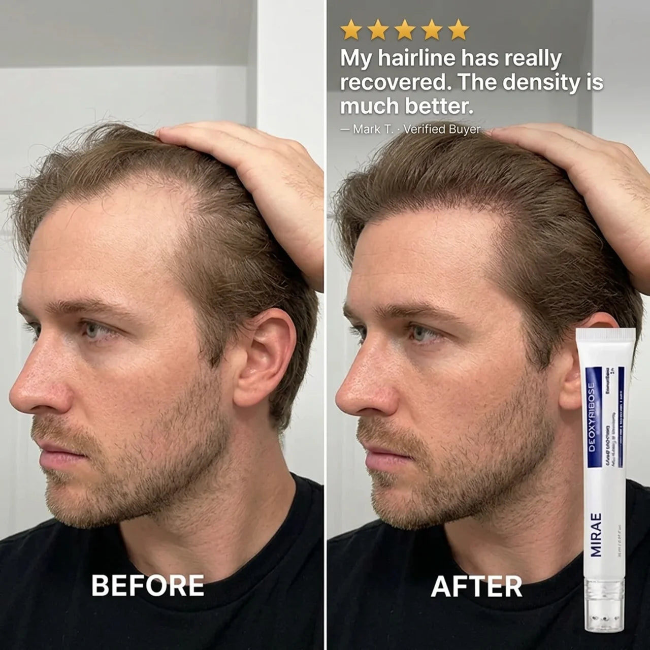 Deoxyribose Scalp Serum